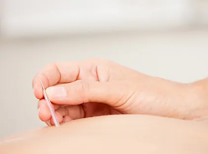 설명한의원 오십견·회전근개 한방 진료에서 한의사가 손으로 침을 환자 피부에 시술하는 침 치료 장면