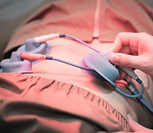 설명한의원 휜다리 교정 진료에서 환자 복부 부위에 전기자극 치료기 패드를 부착하고 손으로 조절하는 모습