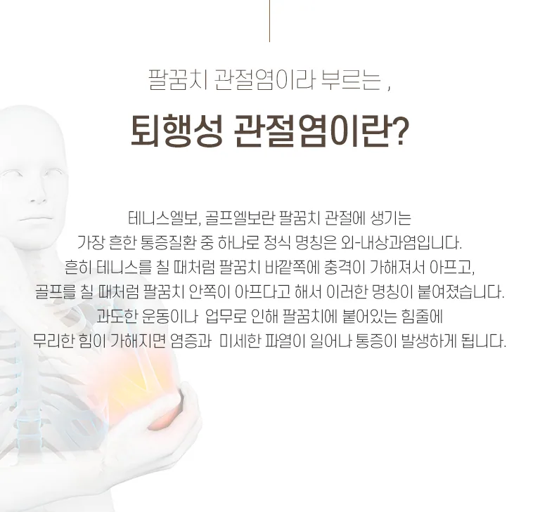 팔꿈치 관절 통증 부위를 붉게 표시한 인체 골격 일러스트와 퇴행성 관절염(테니스엘보·골프엘보) 설명 텍스트. 팔꿈치 관절염이라 부르는, 퇴행성 관절염이란? 테니스엘보, 골프엘보란 팔꿈치 관절에 생기는 가장 흔한 통증질환 중 하나로 정식 명칭은 와-내상과염입니다. 흔히 테니스를 칠 때처럼 팔꿈치 바깥쪽에 충격이 가해져서 아프고, 골프를 칠 때처럼 팔꿈치 안쪽이 아프다고 해서 이러한 명칭이 붙여졌습니다. 과도한 운동이나 업무로 인해 팔꿈치에 붙어있는 힘줄에 무리한 힘이 가해지면 염증과 미세한 파열이 일어나 통증이 발생하게 됩니다.