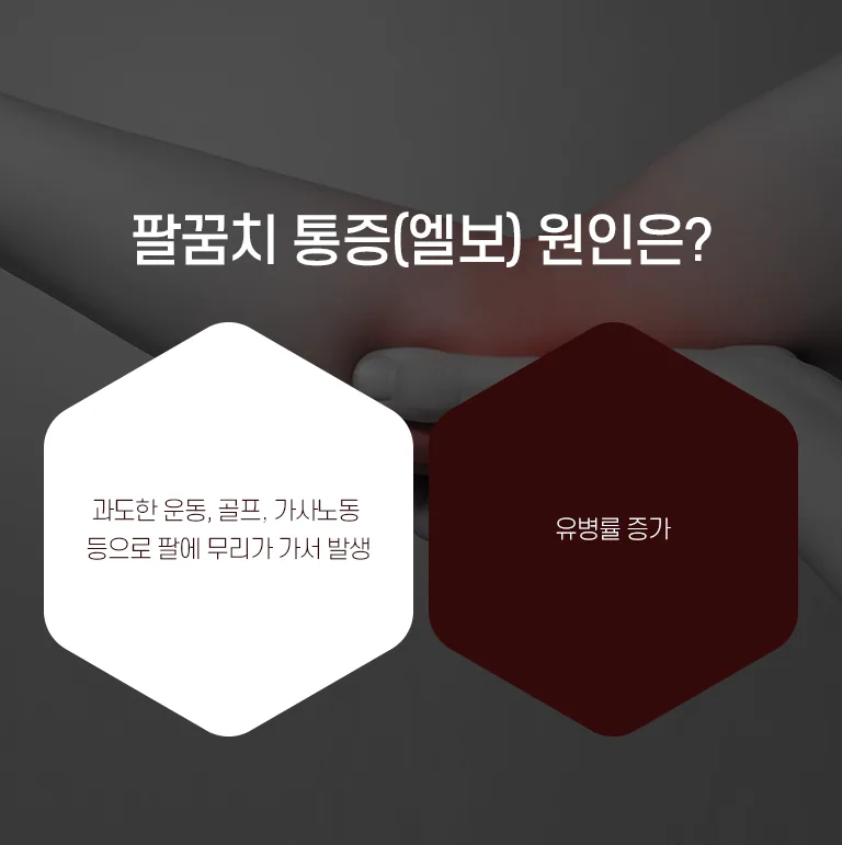 팔꿈치 통증(엘보)의 원인을 설명하는 인포그래픽으로 과도한 운동·골프·가사노동과 유병률 증가를 안내. 팔꿈치 통증(엘보) 원인은? 과도한 운동, 골프, 가사노동 등으로 팔에 무리가 가서 발생 유병률 증가