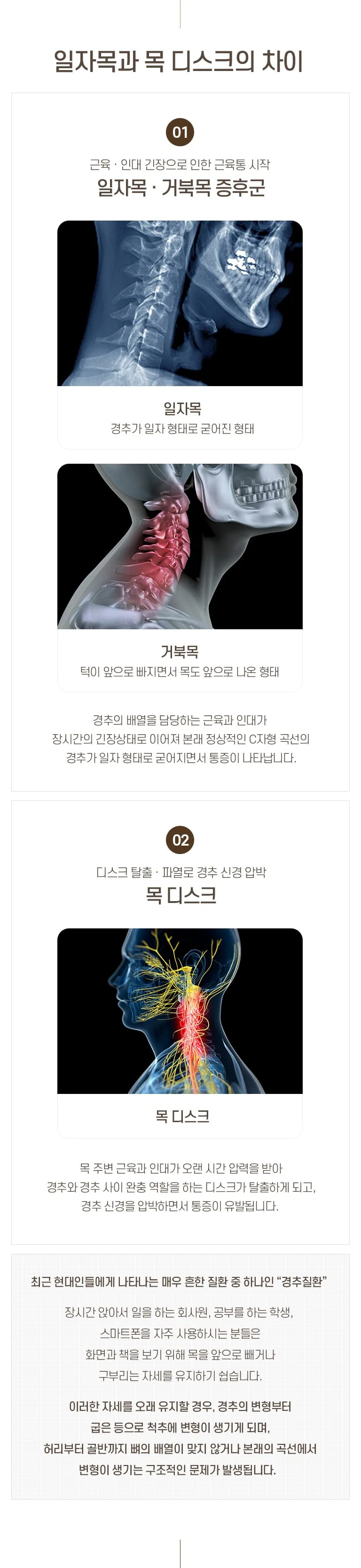 일자목·거북목 증후군과 목 디스크의 차이를 X-레이와 경추 해부 그림으로 비교 설명하는 경추질환 진료소개 인포그래픽. 일자목과 목 디스크의 차이 01 근육 · 인대 긴장으로 인한 근육통 시작 일자목 · 거북목 증후군 일자목 경추가 일자 형태로 굳어진 형태 거북목 턱이 앞으로 빠지면서 목도 앞으로 나온 형태 경추의 배열을 담당하는 근육과 인대가 장시간의 긴장상태로 이어져 본래 정상적인 C자형 곡선의 경추가 일자 형태로 굳어지면서 통증이 나타납니다. 02 디스크 탈출 · 파열로 경추 신경 압박 목 디스크 목 디스크 목 주변 근육과 인대가 오랜 시간 압력을 받아 경추와 경추 사이 완충 역할을 하는 디스크가 탈출하게 되고, 경추 신경을 압박하면서 통증이 유발됩니다. 최근 현대인들에게 나타나는 매우 흔한 질환 중 하나인 “경추질환” 장시간 앉아서 일을 하는 회사원, 공부를 하는 학생, 스마트폰을 자주 사용하시는 분들은 화면과 책을 보기 위해 목을 앞으로 빼거나 구부리는 자세를 유지하기 쉽습니다. 이러한 자세를 오래 유지할 경우, 경추의 변형부터 굽은 등으로 척추에 변형이 생기게 되며, 허리부터 골반까지 뼈의 배열이 맞지 않거나 본래의 곡선에서 변형이 생기는 구조적인 문제가 발생됩니다.