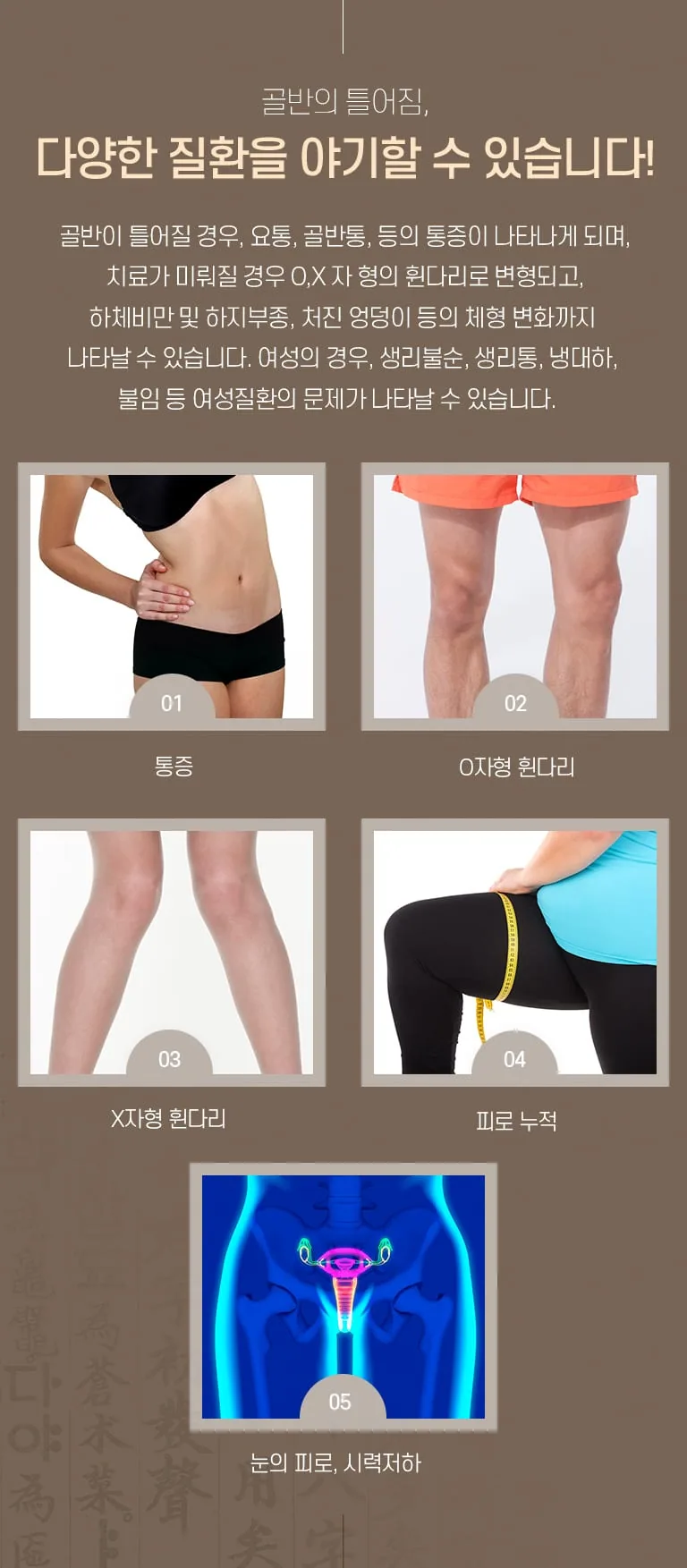 골반 틀어짐으로 나타날 수 있는 증상을 통증·O자형 휜다리·X자형 휜다리·하체비만·여성질환 다섯 가지 사진으로 안내하는 한의원 진료소개 인포그래픽. 골반이 틀어지면 여러 증상이 함께 나타날 수 있습니다. 골반이 틀어질 경우, 요통, 골반통, 등의 통증이 나타나게 되며, 치료가 미뤄질 경우 O, X자 형의 휜다리로 변형되고, 하체비만 및 하지부종, 처진 엉덩이 등의 체형 변화까지 나타날 수 있습니다. 여성의 경우 생리 관련 증상이 함께 나타날 수 있습니다. 01 통증 02 O자형 휜 다리 03 X자형 휜 다리 04 하체비만 05 여성질환