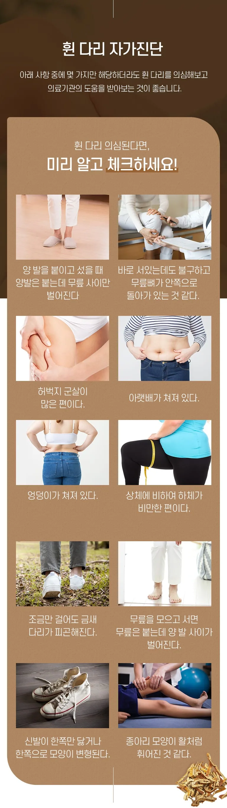 휜 다리 자가진단 인포그래픽으로 양발을 붙여도 무릎 사이가 벌어짐, 종아리 휨 등 체크 항목을 안내한다. 휜 다리 자가진단 아래 사항 중에 몇 가지만 해당하더라도 휜 다리를 의심해보고 의료기관의 도움을 받아보는 것이 좋습니다. 휜 다리 의심된다면, 미리 알고 체크하세요! 양 발을 붙이고 섰을 때 양발은 붙는데 무릎 사이만 벌어진다 바로 서있는데도 불구하고 무릎뼈가 안쪽으로 돌아가 있는 것 같다. 허벅지 군살이 많은 편이다. 아랫배가 쳐져 있다. 엉덩이가 쳐져 있다. 상체에 비하여 하체가 비만한 편이다. 조금만 걸어도 금새 다리가 피곤해진다. 무릎을 모으고 서면 무릎은 붙는데 양 발 사이가 벌어진다. 신발이 한쪽만 닳거나 한쪽으로 모양이 변형된다. 종아리 모양이 활처럼 휘어진 것 같다.