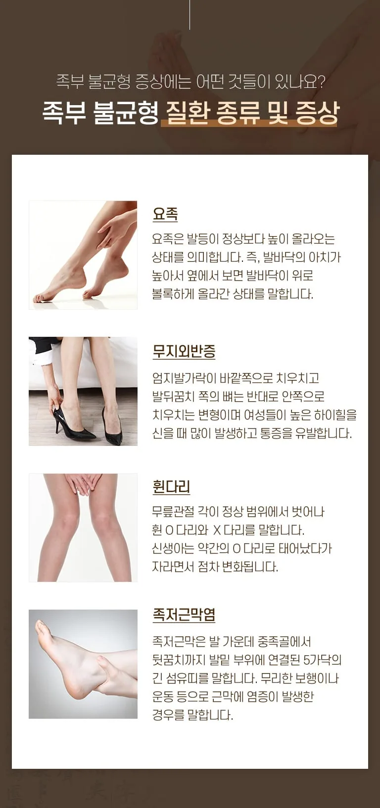 족부 불균형 질환 종류 및 증상 안내. 요족, 무지외반증, 휜다리, 족저근막염의 특징을 사진과 함께 설명한 인포그래픽. 족부 불균형 증상에는 어떤 것들이 있나요? 족부 불균형 질환 종류 및 증상 요족 요족은 발등이 정상보다 높이 올라오는 상태를 의미합니다. 즉, 발바닥의 아치가 높아서 옆에서 보면 발바닥이 위로 볼록하게 올라간 상태를 말합니다. 무지외반증 엄지발가락이 바깥쪽으로 치우치고 발뒤꿈치 쪽의 뼈는 반대로 안쪽으로 치우치는 변형이며 여성들이 높은 하이힐을 신을 때 많이 발생하고 통증을 유발합니다. 휜다리 무릎관절 각이 정상 범위에서 벗어나 휜 O 다리와 X 다리를 말합니다. 신생아는 약간의 O 다리로 태어났다가 자라면서 점차 변화됩니다. 족저근막염 족저근막은 발 가운데 중족골에서 뒷꿈치까지 발밑 부위에 연결된 5가닥의 긴 섬유띠를 말합니다. 무리한 보행이나 운동 등으로 근막에 염증이 발생한 경우를 말합니다.